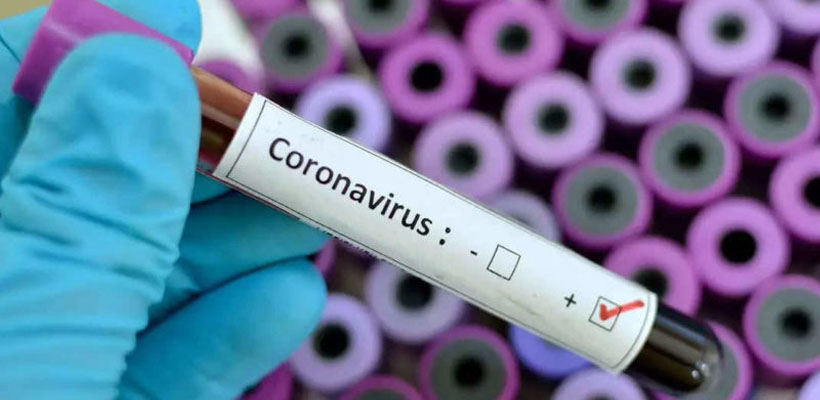 coronavirus-positivo-zaratejpg
