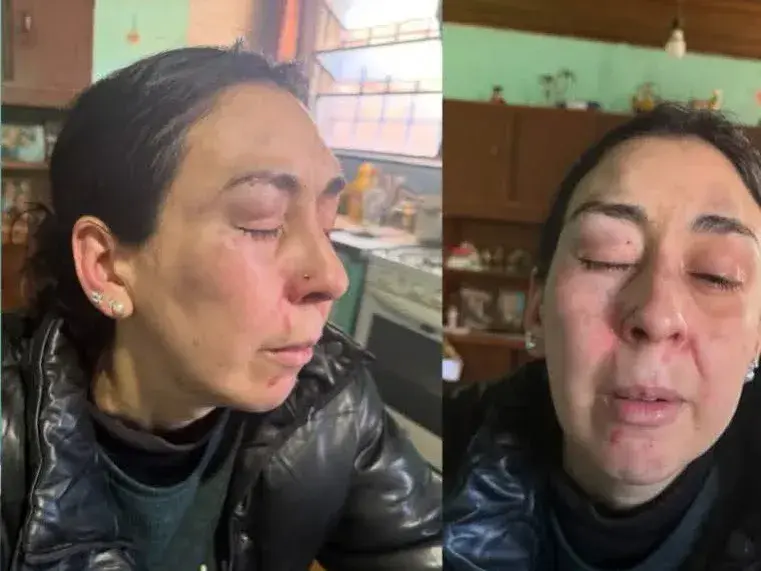 Denuncian a un hombre por esperar y agredir a su expareja a la salida del trabajo